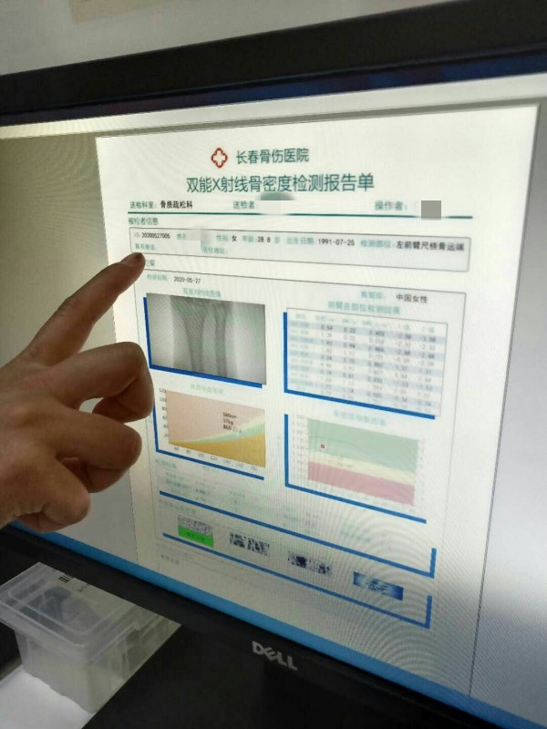 品源雙能X射線骨密度儀落戶吉林省長(zhǎng)春骨傷醫(yī)院，助力骨松診療