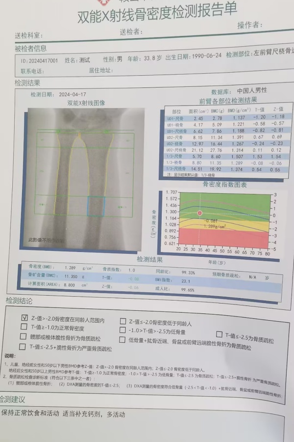 雙能X射線骨密度儀：準(zhǔn)確測(cè)量骨密度，助力骨質(zhì)疏松防治，守護(hù)骨骼健康
